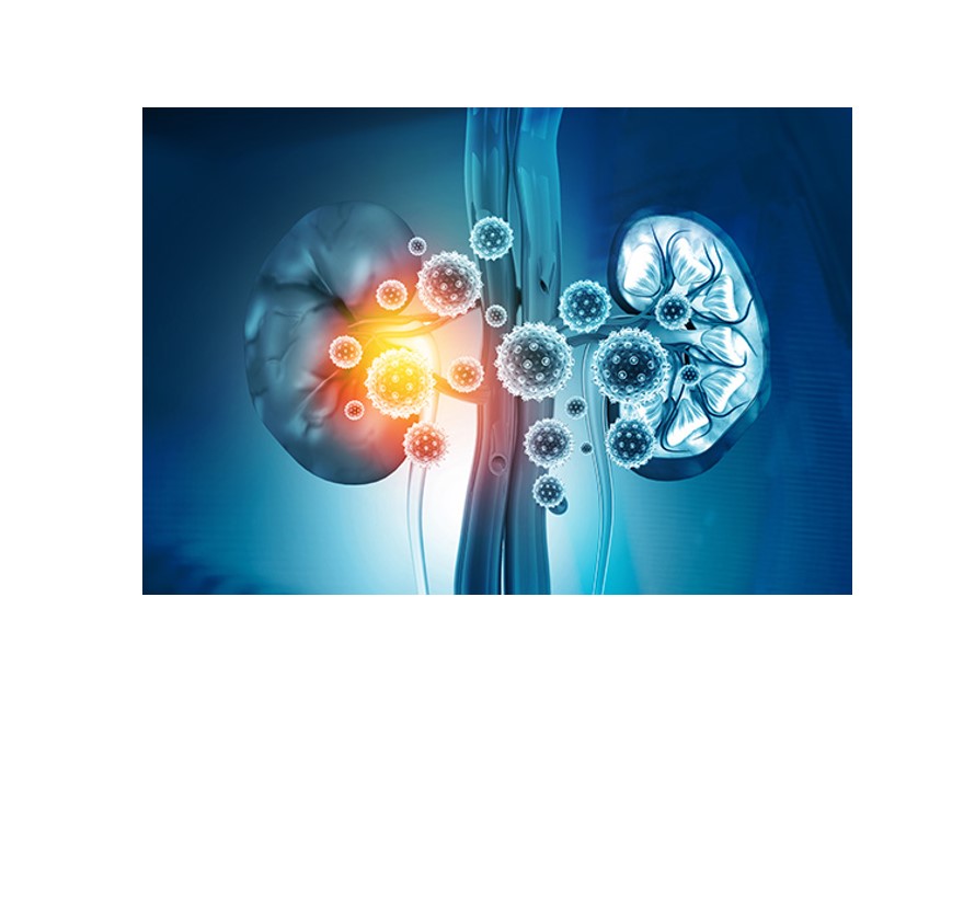 rokit-covid-19-supplement-kidney-research-institute
